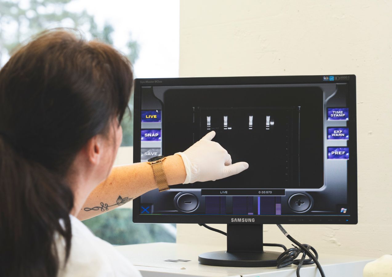 Lab technician Sandra Schneider examining an agarose gel for Chlamydia diagnostics.
